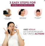 Alite Anti-Acne Skincare Combo Pack of 3