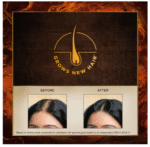 Indulekha Bringha Ayurvedic Hair Oil – 100 ml